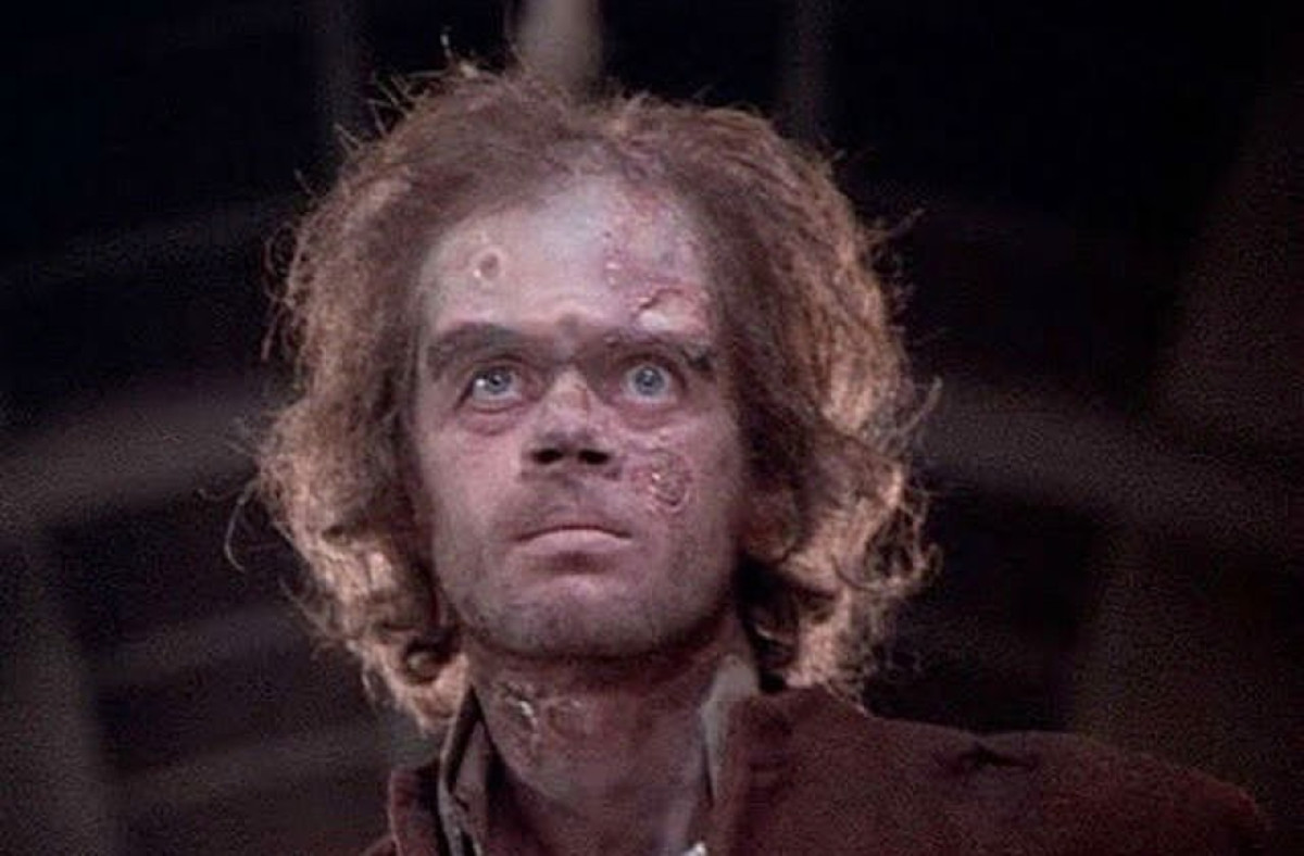 Michael Sarrazin as The Monster in Frankenstein: The True Story (1974)