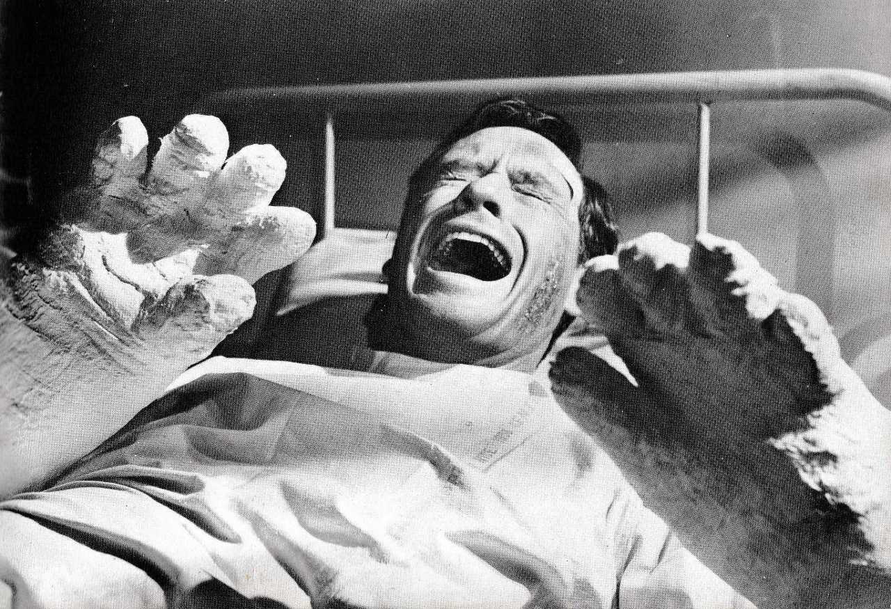 Stephen Orlac (Mel Ferrer) wakes up with transplanted hands in The Hands of Orlac (1960)