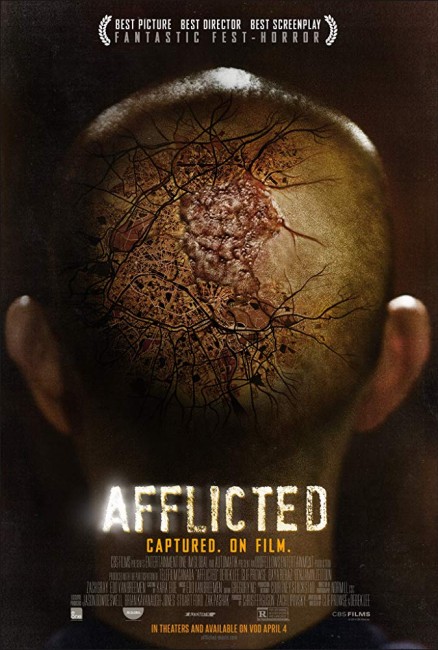 Afflicted (2013) poster